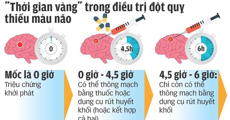 Cấp cứu Phan Thiết cho bệnh nhân đột quỵ