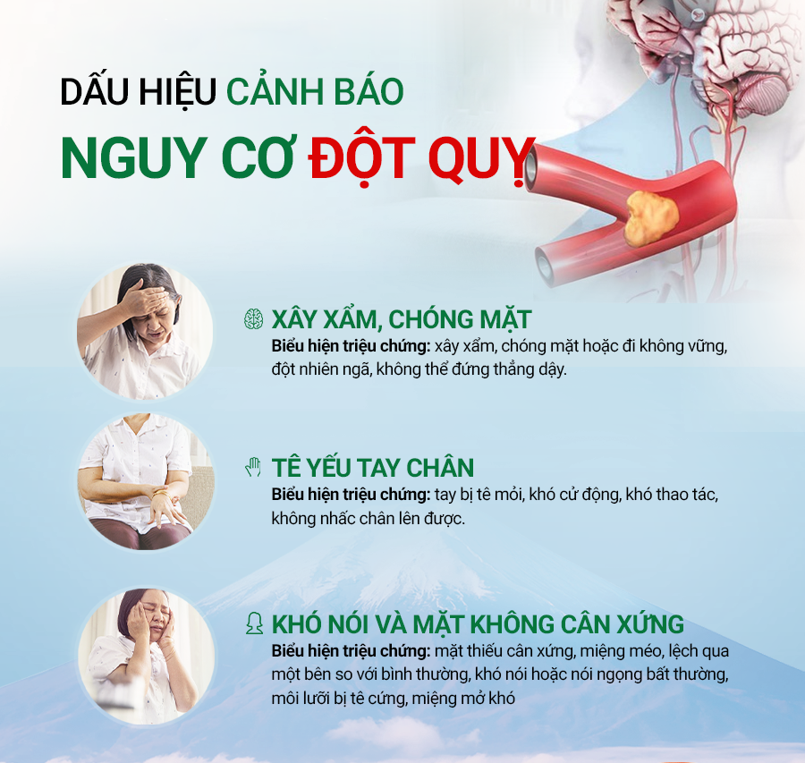 10 Dấu Hiệu Đột Quỵ Sớm Dễ Bị Bỏ Qua – Khi Nào Cần Gọi Cấp Cứu?